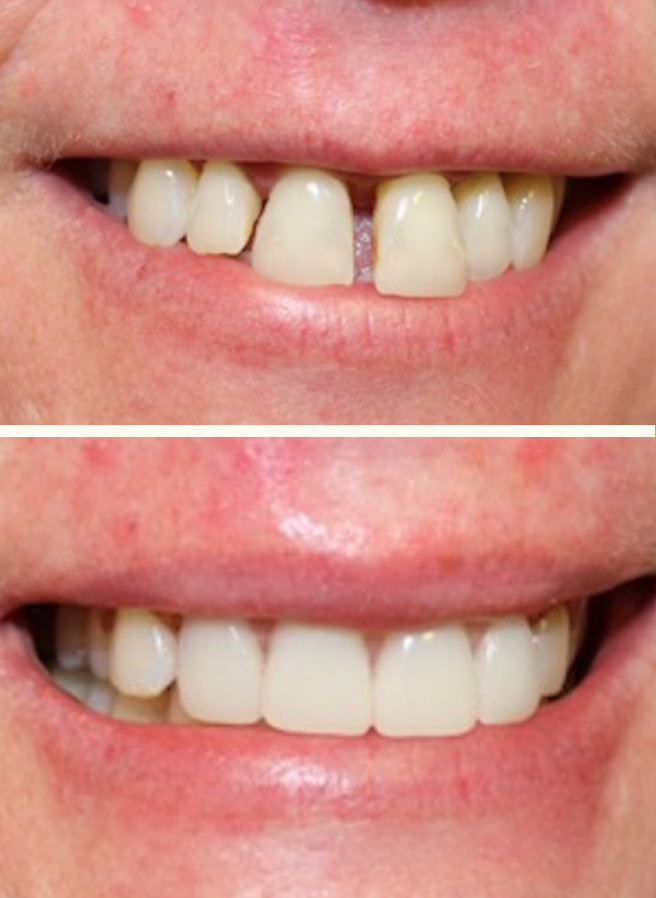 Dentist College Station Before Afters