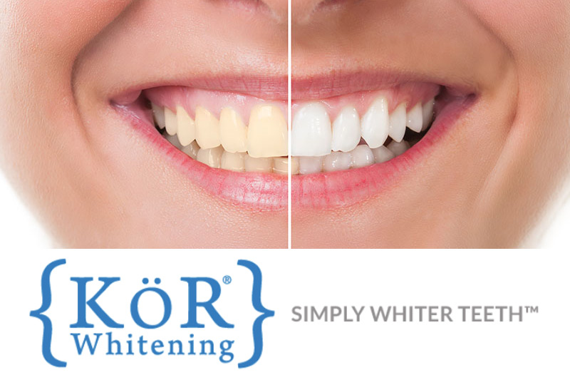 KöR Teeth Whitening in College Station