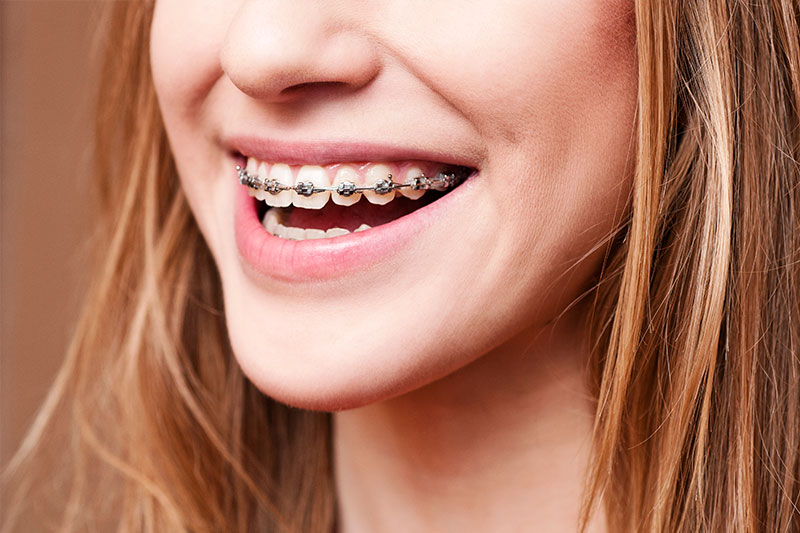 Orthodontics in College Station