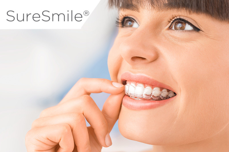 SureSmiles Clear Aligners in College Station